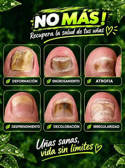 Suero 7 Días | Reparador de Uñas Anti Hongos